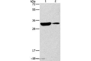 Western blot analysis of Mouse heart and brain tissue, using RCAN1 Polyclonal Antibody at dilution of 1:500 (RCAN1 antibody)