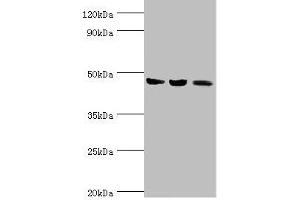 Western blot All lanes: ACAT1 antibody at 6 μg/mL Lane 1: Mouse skeletal musce tissue Lane 2: Rat heart tissue Lane 3: THP-1 whole cell lysate Secondary Goat polyclonal to rabbit IgG at 1/10000 dilution Predicted band size: 46, 18 kDa Observed band size: 46 kDa (ACAT1 antibody  (AA 1-145))