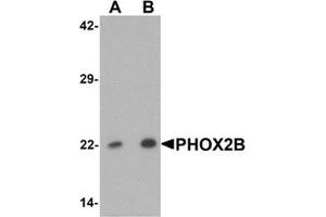 Western blot analysis of PHOX2B in 293 cell lysate with PHOX2B Antibody  at (A) 1 and (B) 2 ug/mL. (PHOX2B antibody  (Middle Region))