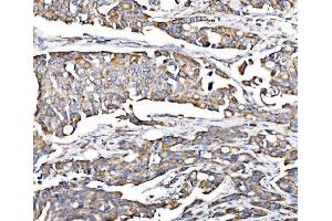 IHC analysis of PMPCA/INPP5 using anti-PMPCA/INPP5 antibody (ABIN7602722). (PMPCA antibody  (AA 99-525))