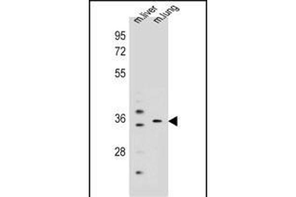 KCNRG Antikörper  (C-Term)