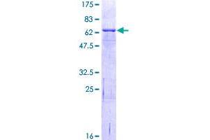 Image no. 1 for Interleukin 1 Receptor Accessory Protein (IL1RAP) (AA 1-356) protein (GST tag) (ABIN1307759)