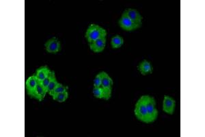 Immunofluorescence staining of HepG2 cells with ABIN7172883 at 1:100, counter-stained with DAPI. (TRPV3 antibody  (AA 1-118))
