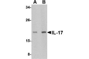 Western Blotting (WB) image for anti-Interleukin 17 (IL17) (N-Term) antibody (ABIN1031409) (IL-17 antibody  (N-Term))