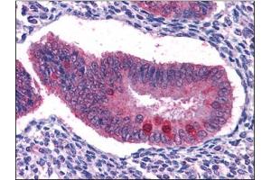 Immunohistochemistry Image: Human Uterus: Formalin-Fixed, Paraffin-Embedded (FFPE) (FOXO3 antibody  (C-Term))