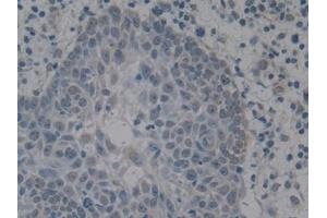 Immunohistochemistry (IHC) image for anti-High Mobility Group Box 1 (HMGB1) (AA 9-163) antibody (ABIN7442177)
