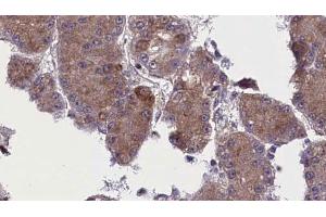 Immunohistochemistry (IHC) image for anti-Olfactory Receptor, Family 52, Subfamily N, Member 5 (OR52N5) (C-Term) antibody (ABIN6263880)