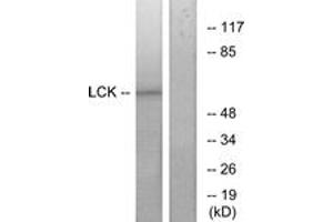 Western blot analysis of extracts from 293 cells, treated with serum 15% 10', using Lck (Ab-393) Antibody. (LCK antibody  (AA 361-410))