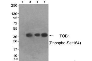 Western blot analysis of extracts from HeLa cells (Lane 2), A549 cells (Lane 3) and HepG2 cells (Lane 4), using TOB1 (Phospho-Ser164) Antibody. (Protein Tob1 (TOB1) (pSer164) antibody)