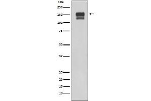 Western Blotting (WB) image for anti-Integrin beta 1 (ITGB1) antibody (ABIN7606854)