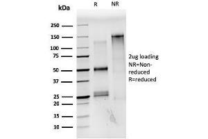 SDS-PAGE Analysis Purified Estrogen Receptor alpha Mouse Monoclonal Antibody (ESR1/3559). (Estrogen Receptor alpha antibody  (AA 129-312))
