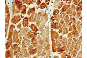 Immunohistochemistry of paraffin-embedded human heart tissue using ABIN7163159 at dilution of 1:100 (PIK3C3 antibody  (Catalytic Subunit))