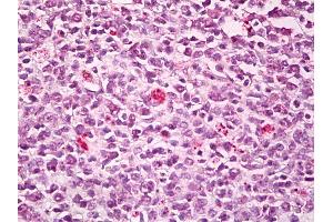 Anti-SWAP70 antibody IHC of human tonsil, germinal center. (SWAP70 antibody  (AA 1-50))