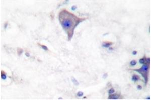Image no. 2 for anti-Claudin 5 (CLDN5) antibody (ABIN265364) (Claudin 5 antibody)