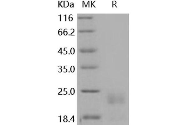 SPINT2 Protein (His tag)