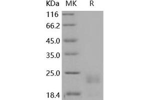 Western Blotting (WB) image for serine Peptidase Inhibitor, Kunitz Type, 2 (SPINT2) protein (His tag) (ABIN7197930) (SPINT2 Protein (His tag))