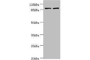 Western blot All lanes: GCC1 antibody at 2 μg/mL Lane 1: Hela whole cell lysate Lane 2: 293T whole cell lysate Secondary Goat polyclonal to rabbit IgG at 1/10000 dilution Predicted band size: 88 kDa Observed band size: 88 kDa (GCC1 antibody  (AA 4-775))
