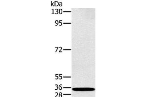 Western Blot analysis of K562 cell using RAB27A Polyclonal Antibody at dilution of 1:400 (RAB27A antibody)