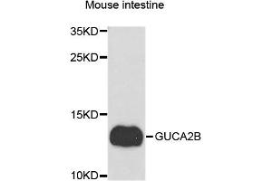 Western blot analysis of extracts of Mouse intestine cells, using GUCA2B antibody.