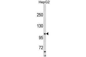 Western blot analysis of AP2A2 Antibody (Center) in HepG2 cell line lysates (35ug/lane). (AP2A2 antibody  (Middle Region))