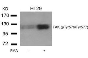 Image no. 2 for anti-PTK2 Protein tyrosine Kinase 2 (PTK2) (pTyr576), (pTyr577) antibody (ABIN401608) (FAK antibody  (pTyr576, pTyr577))