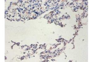 Immunohistochemistry of paraffin-embedded human lung tissue using ABIN7171713 at dilution of 1:100 (TERT antibody  (AA 281-436))