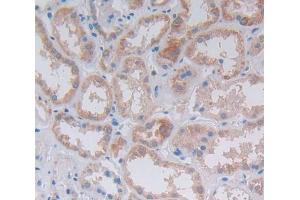 IHC-P analysis of Kidney tissue, with DAB staining. (ILK antibody  (AA 183-452))