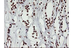 Immunohistochemical staining of paraffin-embedded Human Kidney tissue using anti-GSTT2 mouse monoclonal antibody.