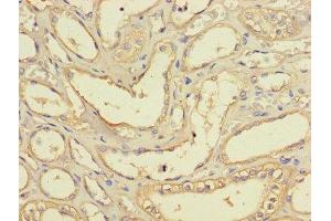 Immunohistochemistry of paraffin-embedded human kidney tissue using ABIN7158679 at dilution of 1:100 (BRCC3 antibody  (AA 14-316))