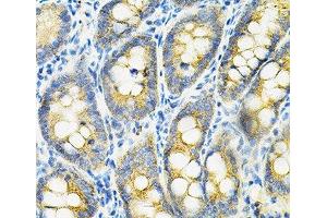 Immunohistochemistry of paraffin-embedded Rat intestine using HGF Polyclonal Antibody at dilution of 1:100 (40x lens). (HGF antibody)