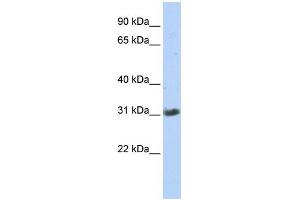 WB Suggested Anti-ZFAND3 Antibody Titration:  0. (ZFAND3 antibody  (Middle Region))