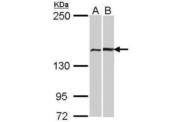 FANCA antibody  (N-Term)