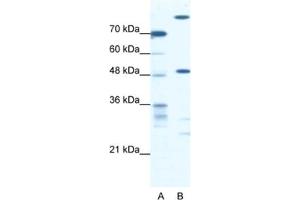 Western Blotting (WB) image for anti-NFS1, Cysteine Desulfurase (NFS1) antibody (ABIN2460657) (NFS1 antibody)