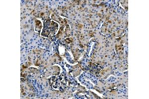 IHC analysis of ASS1 using anti-ASS1 antibody (ABIN7601191). (ASS1 antibody  (AA 3-365))