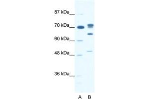 Western Blotting (WB) image for anti-DEAD (Asp-Glu-Ala-Asp) Box Polypeptide 21 (DDX21) antibody (ABIN2461343) (DDX21 antibody)