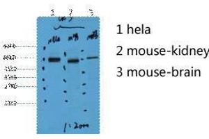Western Blot (WB) analysis of 1) HeLa, 2) Mouse Kidney, 3) Mouse Brain, diluted at 1:2000. (Cytokeratin 7 antibody)