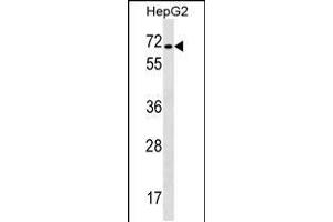 Western blot analysis in HepG2 cell line lysates (35ug/lane). (CACNB1 antibody  (C-Term))