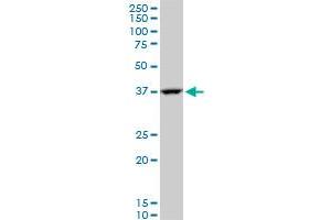 GOT2 polyclonal antibody (A01), Lot # FHC0061120QCS1. (GOT2 antibody  (AA 331-430))