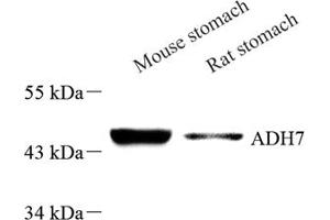 Western blot analysis of ADH7 (ABIN7072995) at dilution of 1: 500 (ADH7 antibody)