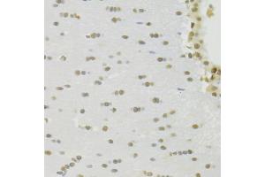 Immunohistochemistry of paraffin-embedded rat brain using RBPJ Antibody (ABIN1876876) at dilution of 1:100 (40x lens). (RBPJ antibody)