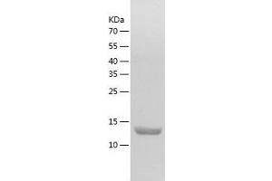 Western Blotting (WB) image for Hemoglobin theta 1 (HBQ1) (AA 1-142) protein (His tag) (ABIN7285177) (HBQ1 Protein (AA 1-142) (His tag))