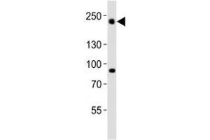 Western blot analysis of lysate from HeLa cell line using Dnmt1 antibody diluted at 1:1000.