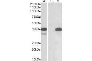 HEK293 lysate (10ug protein in RIPA buffer) overexpressing Human PIM2 with C-terminal MYC tag probed with ABIN1590101 (0. (PIM2 antibody  (C-Term))
