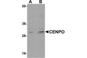 Western blot analysis of CENPO in mouse kidney tissue lysate with AP30224PU-N CENPO antibody at (A) 1 and (B) 2 μg/ml. (CENPO antibody  (Center))