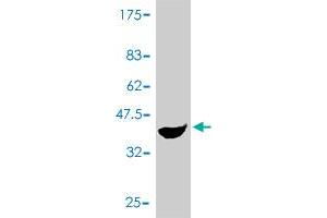Western Blot detection against Immunogen (37. (PCBD1 antibody  (AA 1-104))