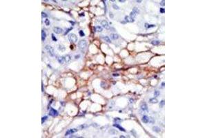 Image no. 2 for anti-Phosphatidylinositol-5-Phosphate 4-Kinase, Type II, alpha (PIP4K2A) (N-Term) antibody (ABIN360482) (PIP4K2A antibody  (N-Term))