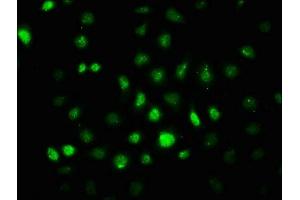 Immunofluorescence staining of A549 cells with ABIN7127692 at 1:100,counter-stained with DAPI. (Recombinant PRKAA2 antibody  (pThr172))