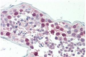 Human Testis: Formalin-Fixed, Paraffin-Embedded (FFPE) (CSTF1 antibody  (AA 1-50))