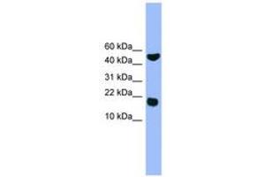 Image no. 1 for anti-RWD Domain Containing 1 (RWDD1) (AA 41-90) antibody (ABIN6746575) (RWDD1 antibody  (AA 41-90))