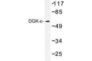 Western blot analysis of DGK-ε antibody in extracts from K562 cells. (DGKE antibody)